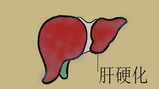 通常情况下，会出现这个疾病，是有很多因素导致的