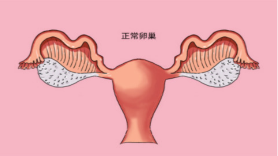 卵巢早衰目前由于病因不是很明确,所以没有确切有效的方法可以恢复