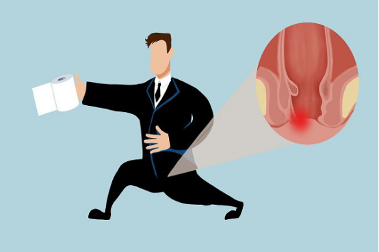 　这种疾病的产生和患者的生活习惯有着很大的关系