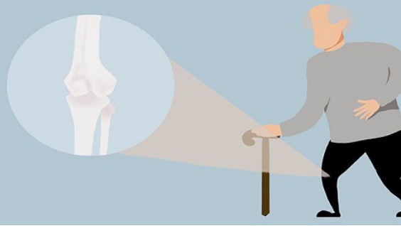 　一般粉碎性骨折发生后，立即不要动保持原有的姿势
