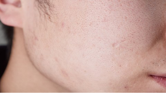 大部分人在生病的时候，因为身体不舒服，所以很少能主动吃比较多的食物