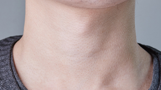 当患者出现这个疾病的时候，身体里面的动脉，都是会有不同程度的硬化现象