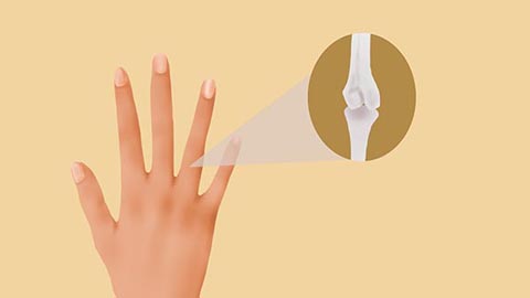 如果手指的皮肤组织出现了流血和断裂时，患者需要尽快到医院进行治疗