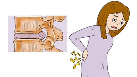 大部分的患者会出现这个疾病，都是跟自己的姿势和习惯