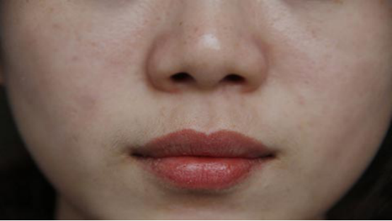 女生嘴巴上面长胡子怎么办