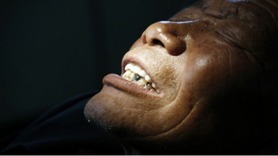 板牙疼痛时候,需要检查一下造成板牙疼痛的原因