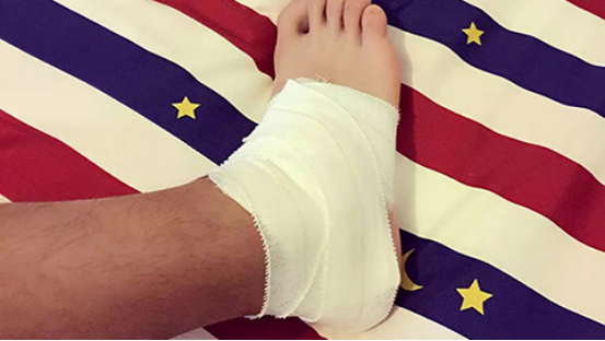 发生踝关节扭伤后，会出现非常强烈的疼痛感