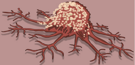 鳞状细胞癌抗原是什么意思