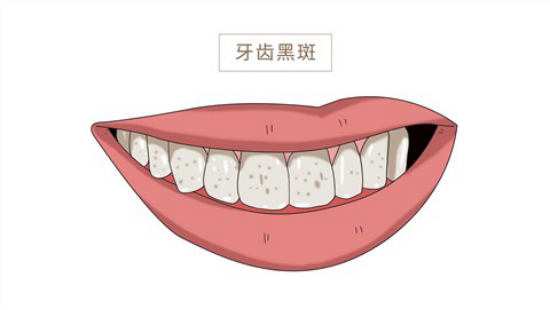 临床上医生会根据患者的病情进展制定治疗方案，尽可能保留患者的牙齿