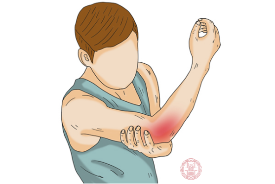 手臂酸痛是什么原因导致的