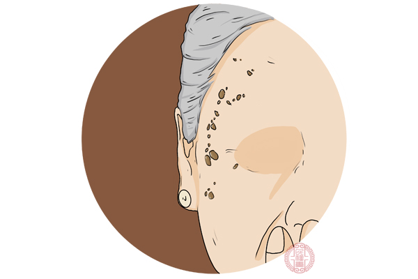 阳光中的各种射线会对皮肤造成比较大的伤害,经常晒太阳的人会比较黑