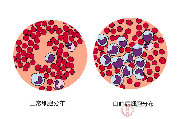 白細胞低到多少會有危險