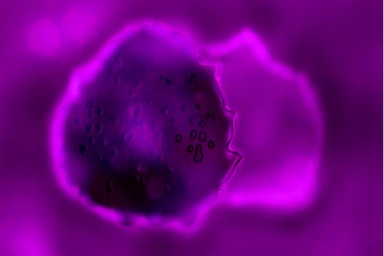 生殖道黏膜的可发生微小破损 生殖道黏膜的可发生微小破损