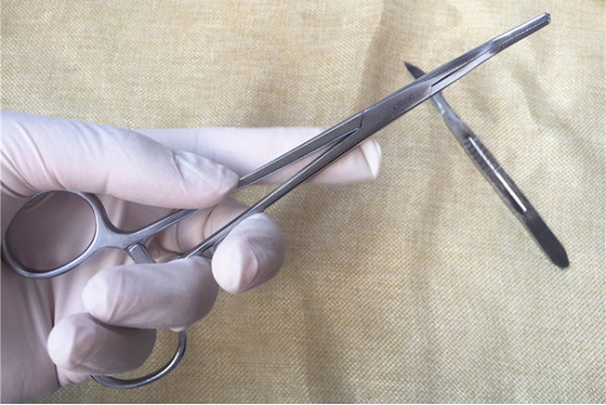 持续性感染高危HPV感染宫颈病变手术治疗