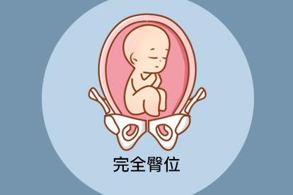 胎儿臀位 孕晚期图片